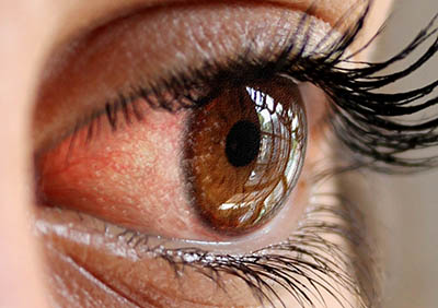 Close-up of an eye wearing a contact lens