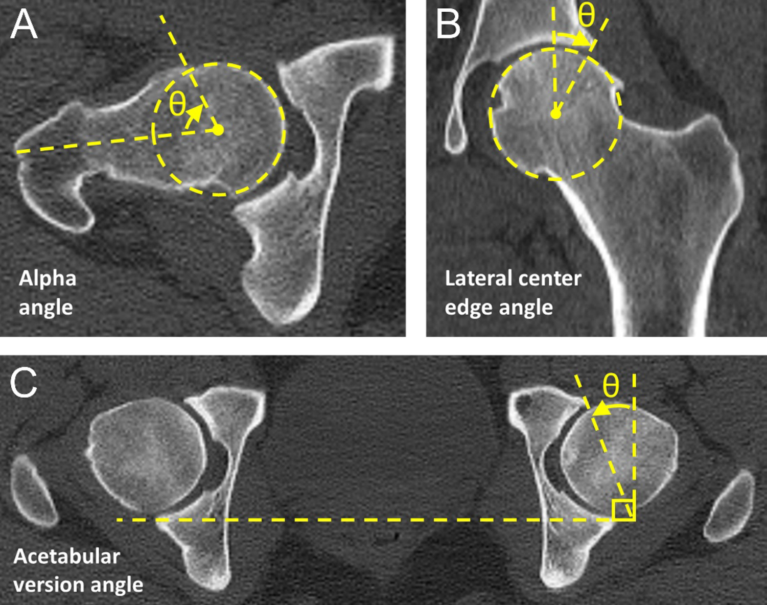 Investigación en biomecánica